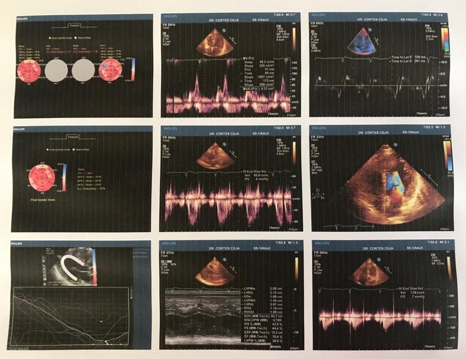 Juan Manuel Cortés Ceja-0
