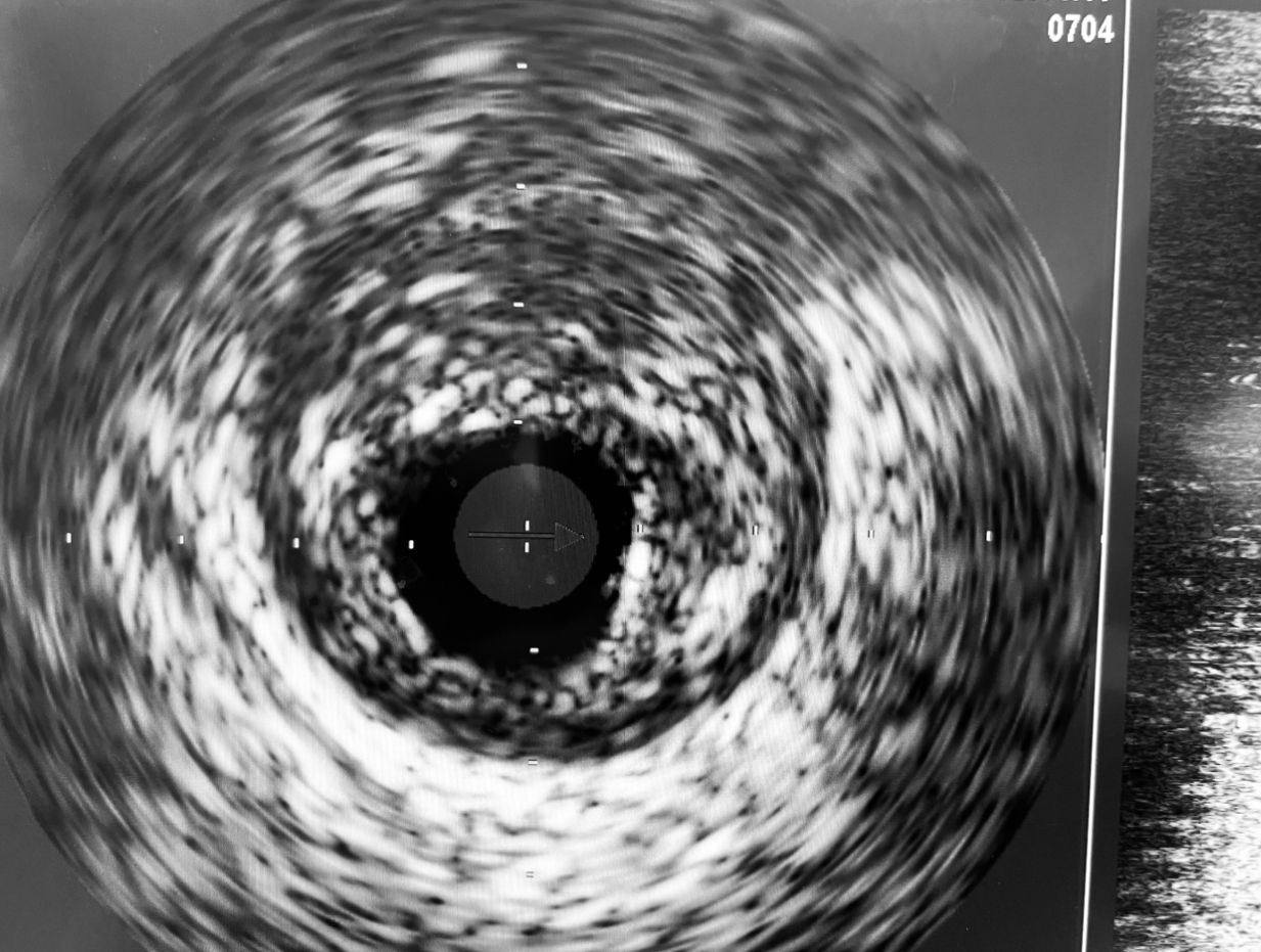 Abdón Ávila Chávez-1