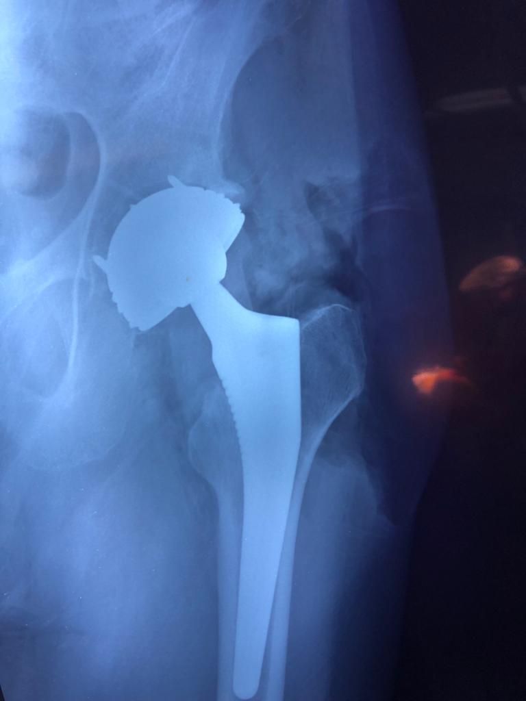 Aecio Madrigal Méndez-21