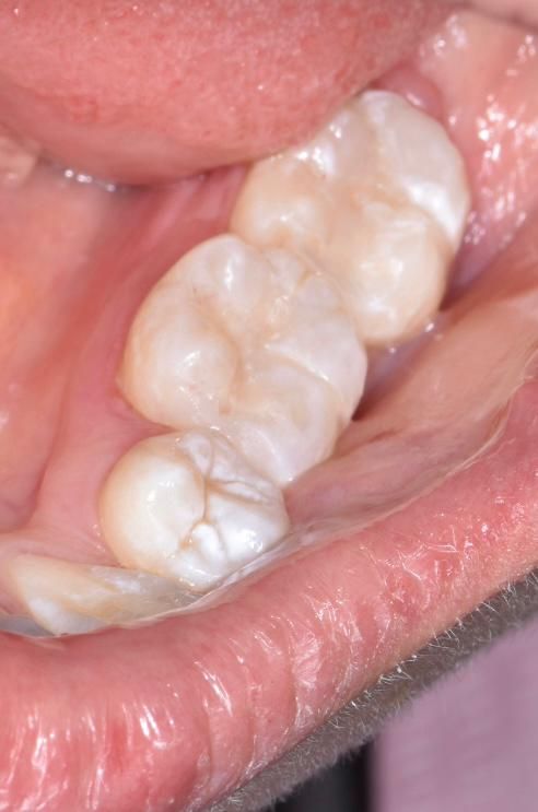 Andrea Moncada Rmz-15