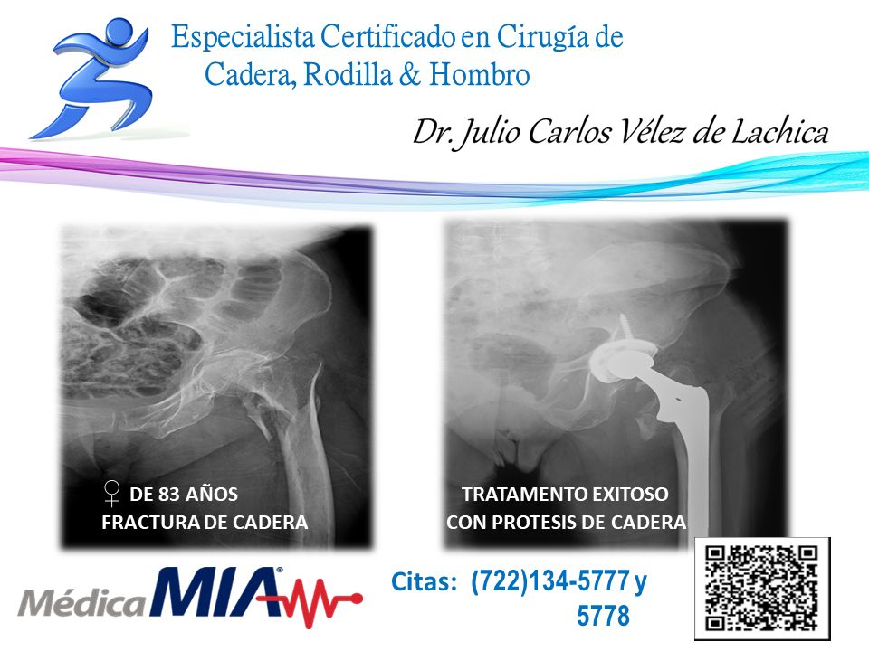 Julio Carlos Vélez De Lachica-35