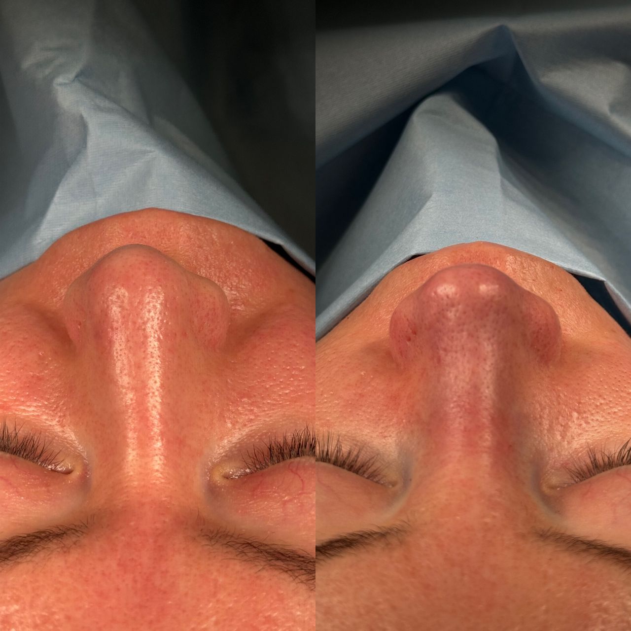 Angel Castro Urquizo-136