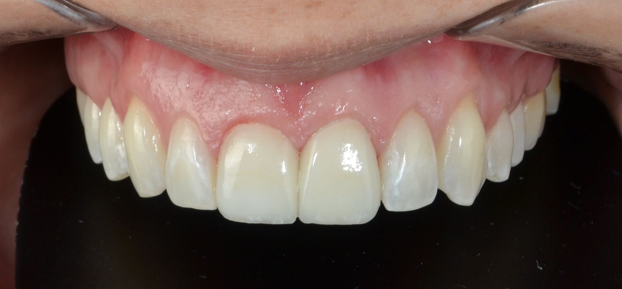 Francisco Jose Vives Serrano-11