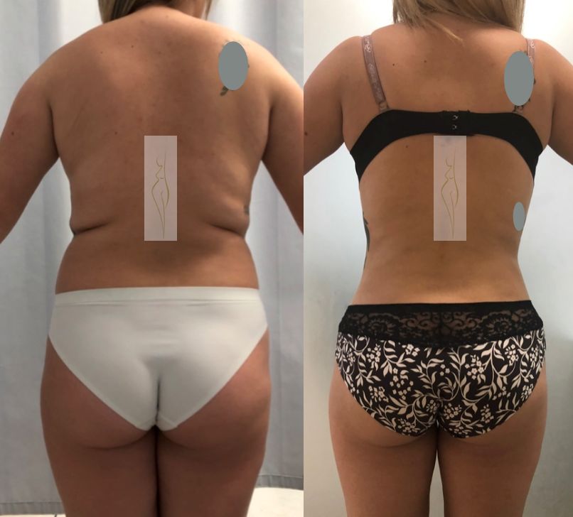 Rubén Nieto Balcázar-8