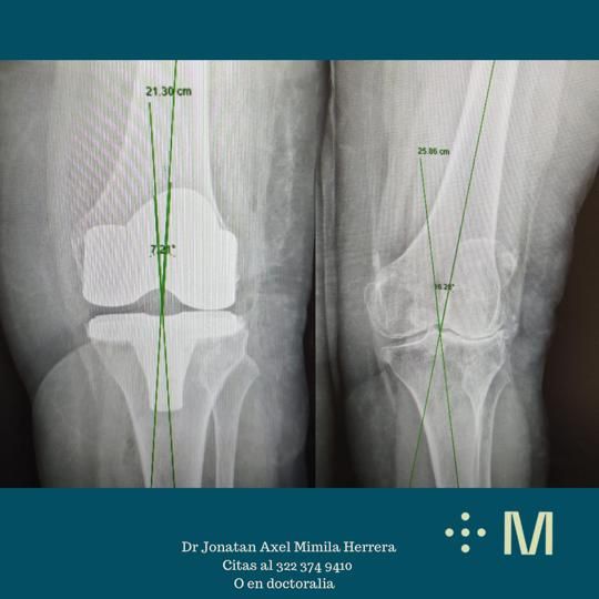 Jonatan Axel Mimila Herrera-0
