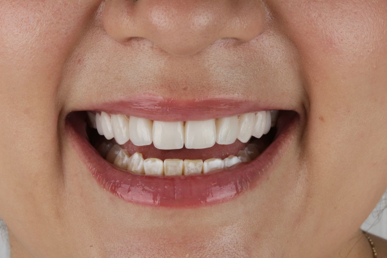 Sebastian Enrique Pérez Alvarez-0