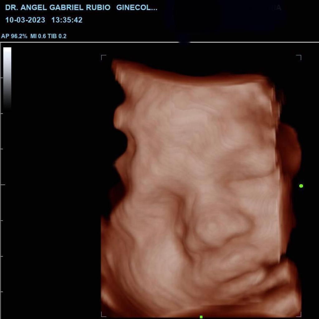 Ángel Gabriel Rubio Campos-7