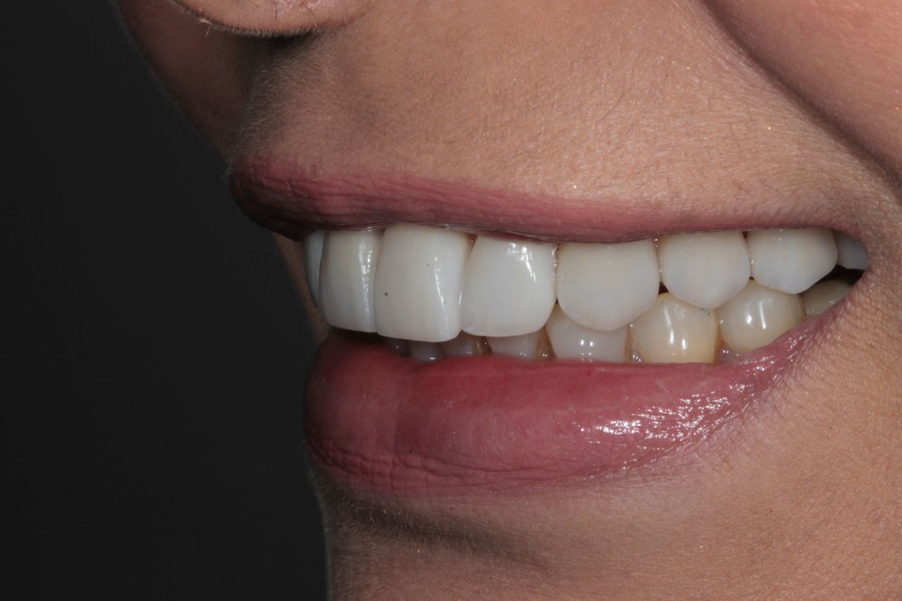 Mariel Itzayani Torres López-44