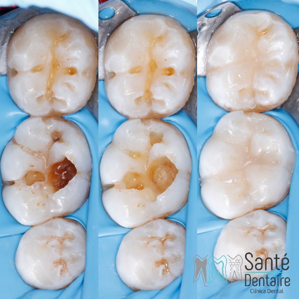 Daniel Oñate Robledo-31