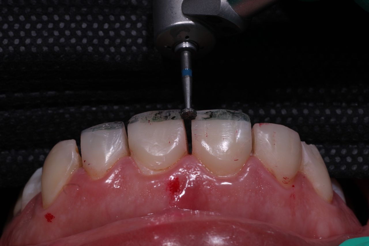 Fredy Alejandro Roblero Gónzalez-60