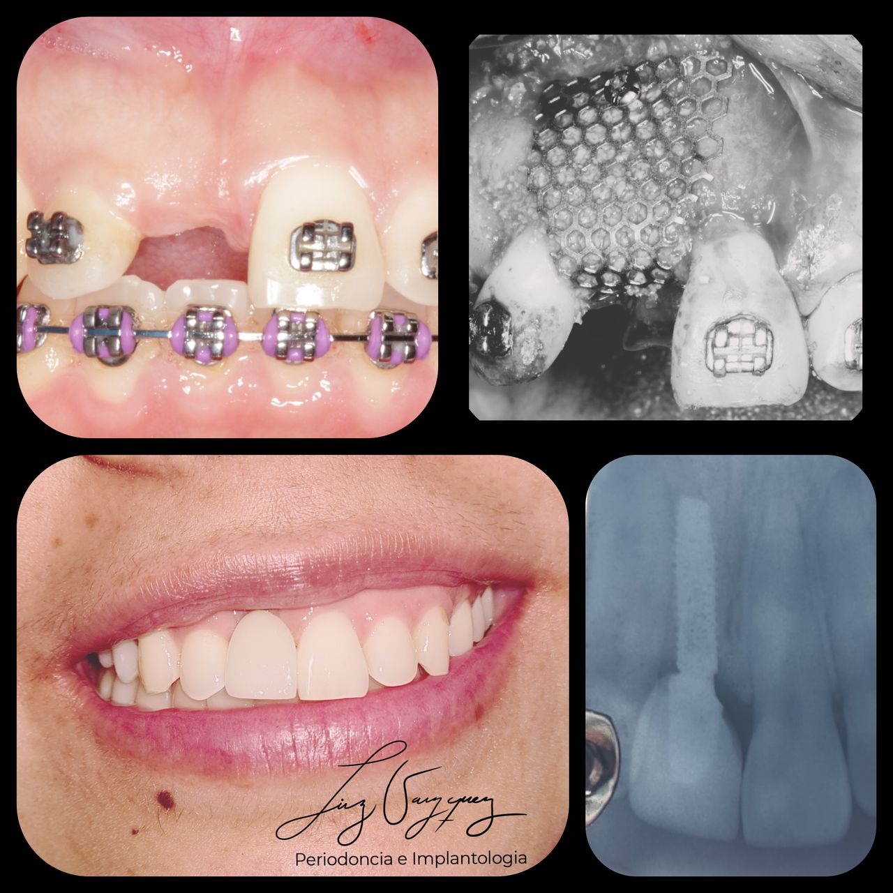 Liz Estela Vazquez Cruz-0