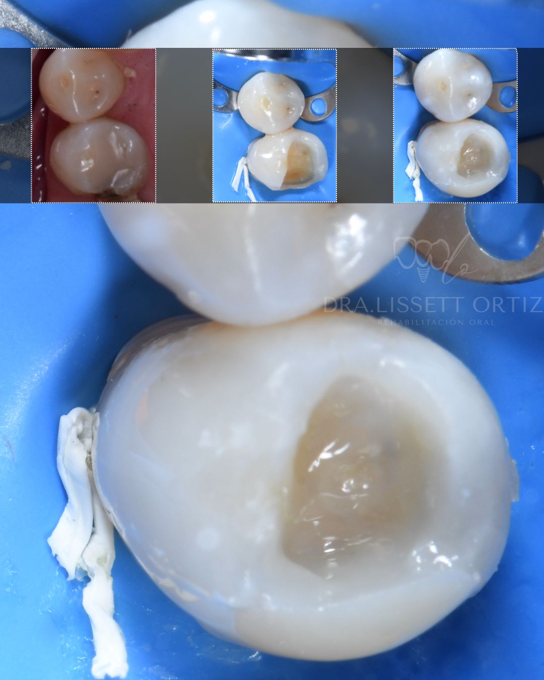 Ana Lissett Ortiz-20