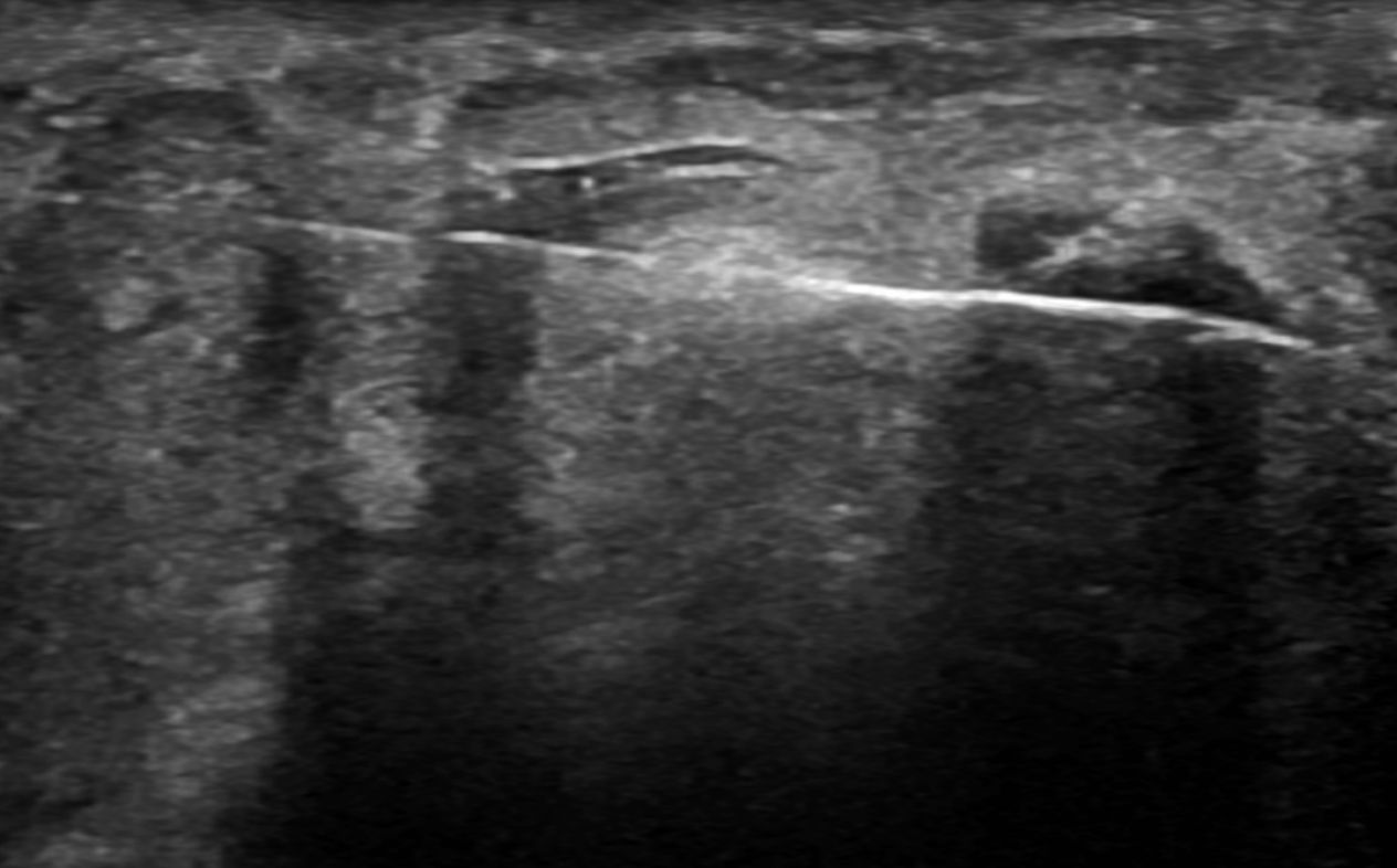 Luis Alonzo Briseño Salas-7