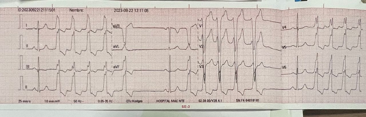 Abdón Ávila Chávez-17