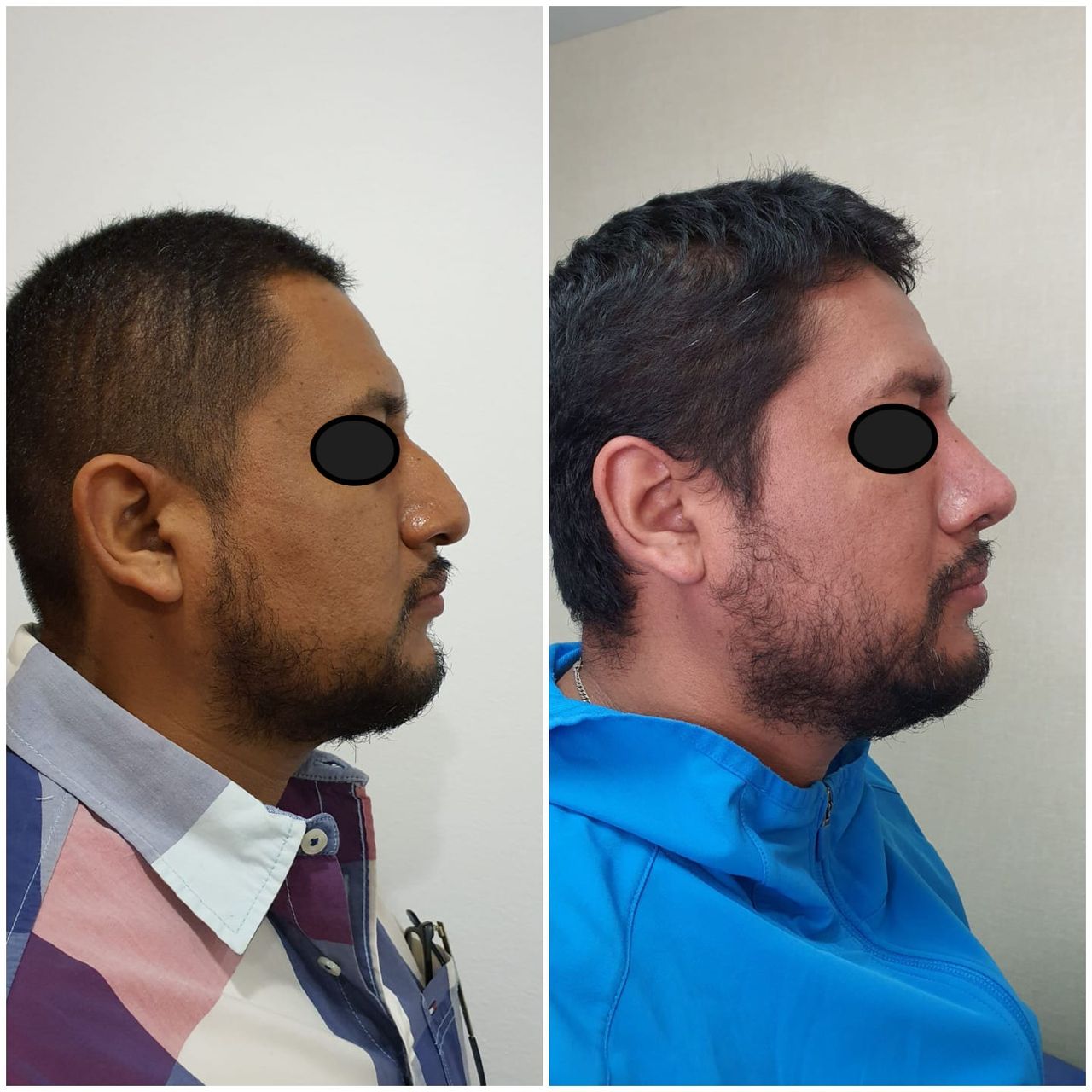 Fernando Nicolas Gonzalez Gonzalez-16