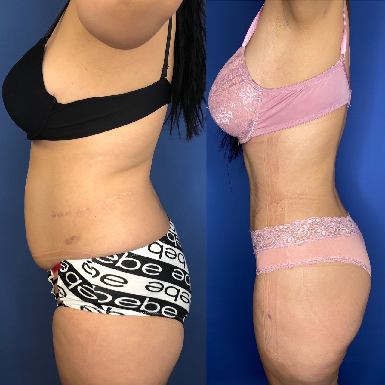 Luis Atilio Gil Pérez-10