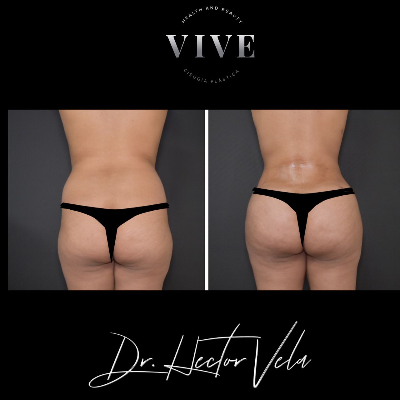 Héctor Eduardo Vela Cardona-200