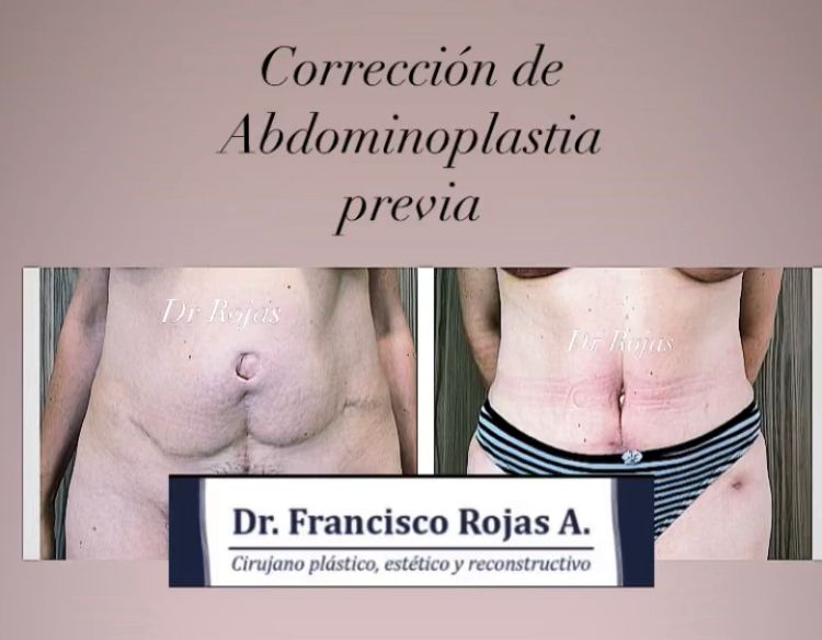 Francisco Rojas Aguilar-13