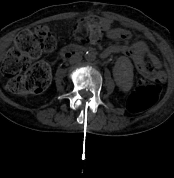 Luis Alonzo Briseño Salas-3