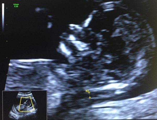 Susana Soto López-3