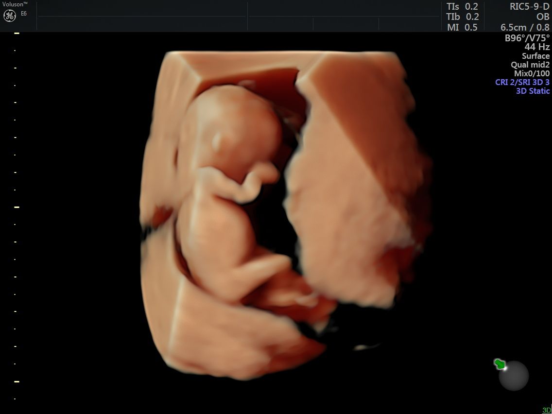 Edgardo Reyes Ponce-6