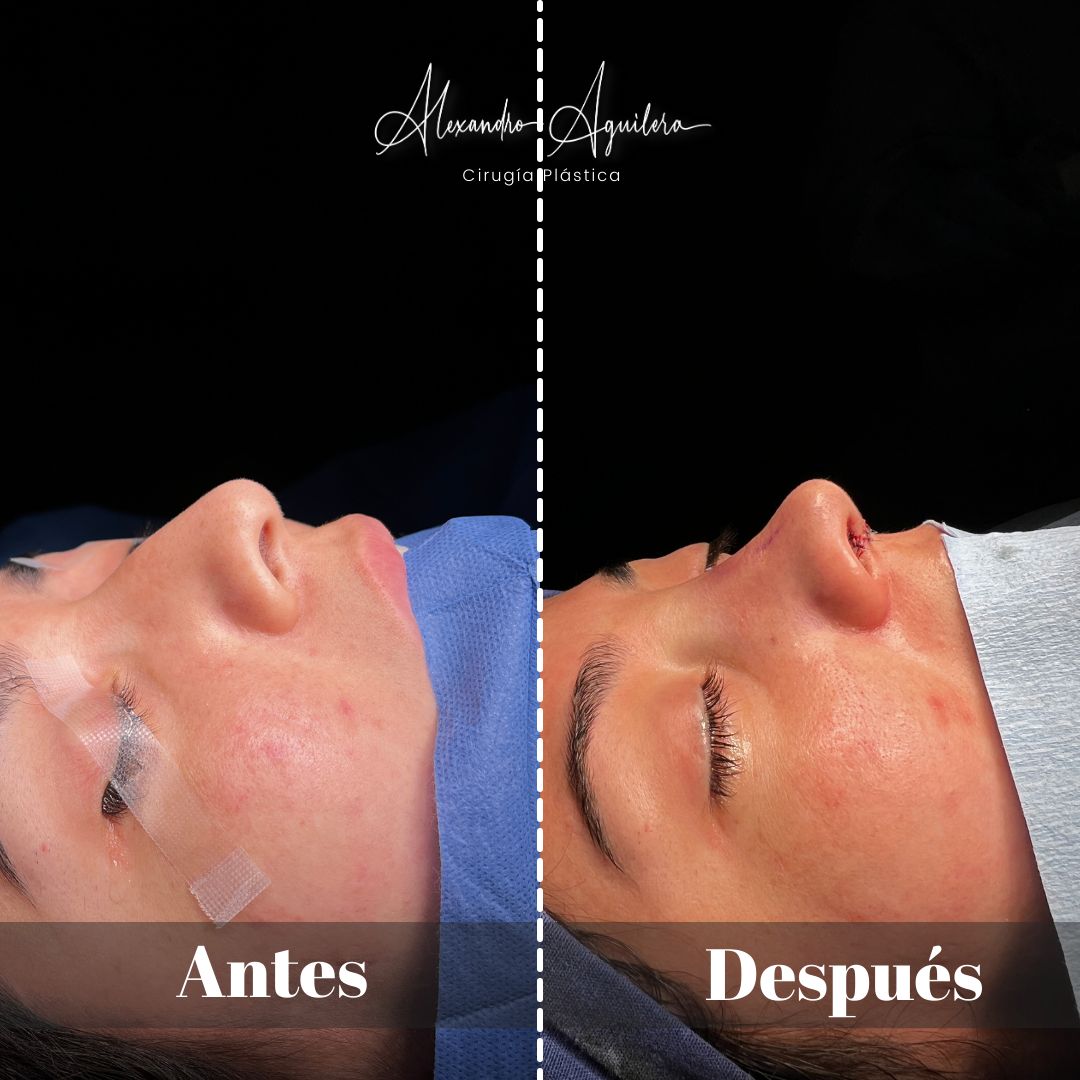 Alexandro Aguilera Salgado-49