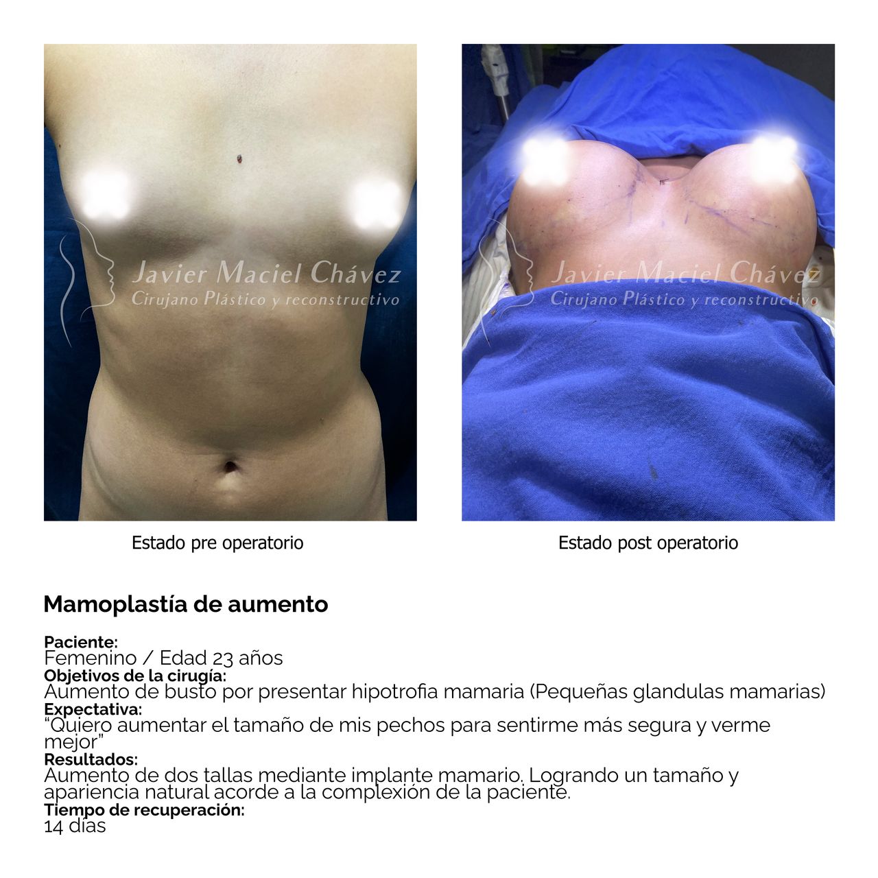 Javier Maciel Chávez-18