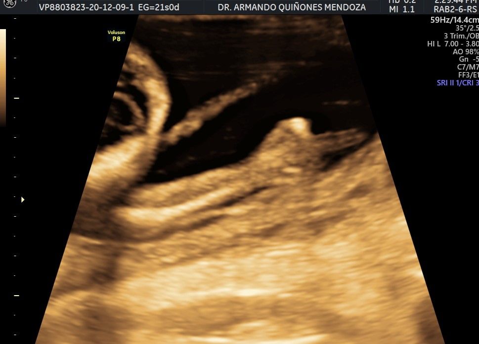 Armando Quiñones Mendoza-18