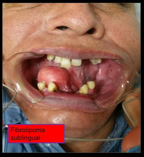 Diana Araceli Dávila Hernández-25