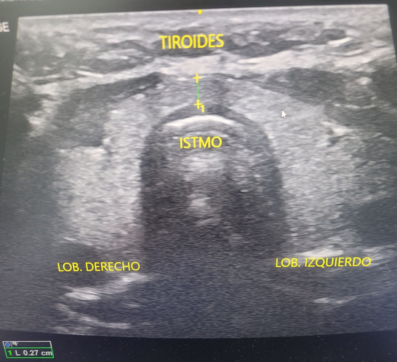 Einar Arik Nuñez Sanchez-8