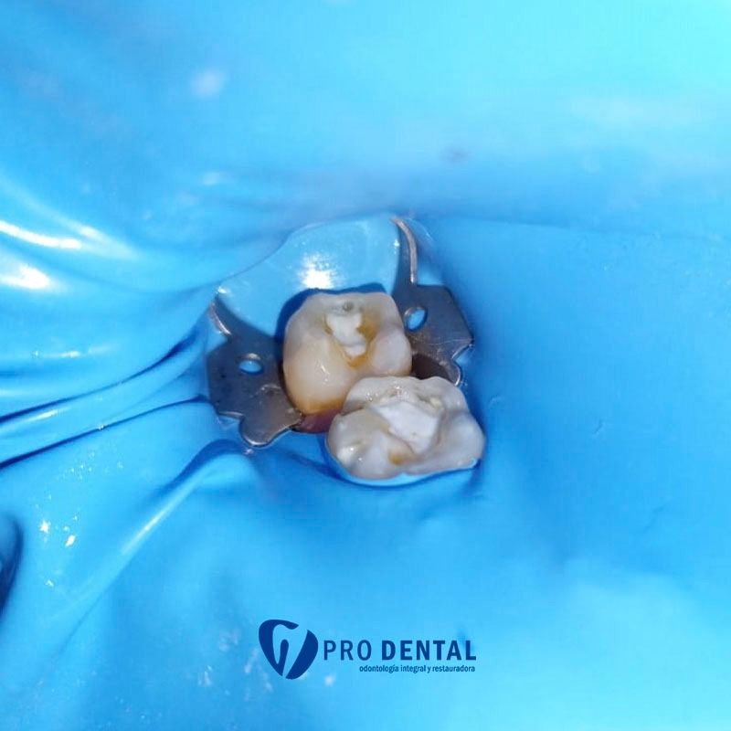 Maria Del Carmen Canul Guzman-7