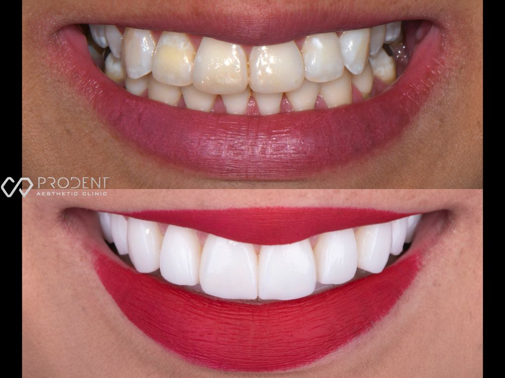 Ulises Pérez Murillo-77