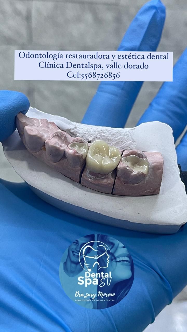 Zury Sarai Moreno Soto-40