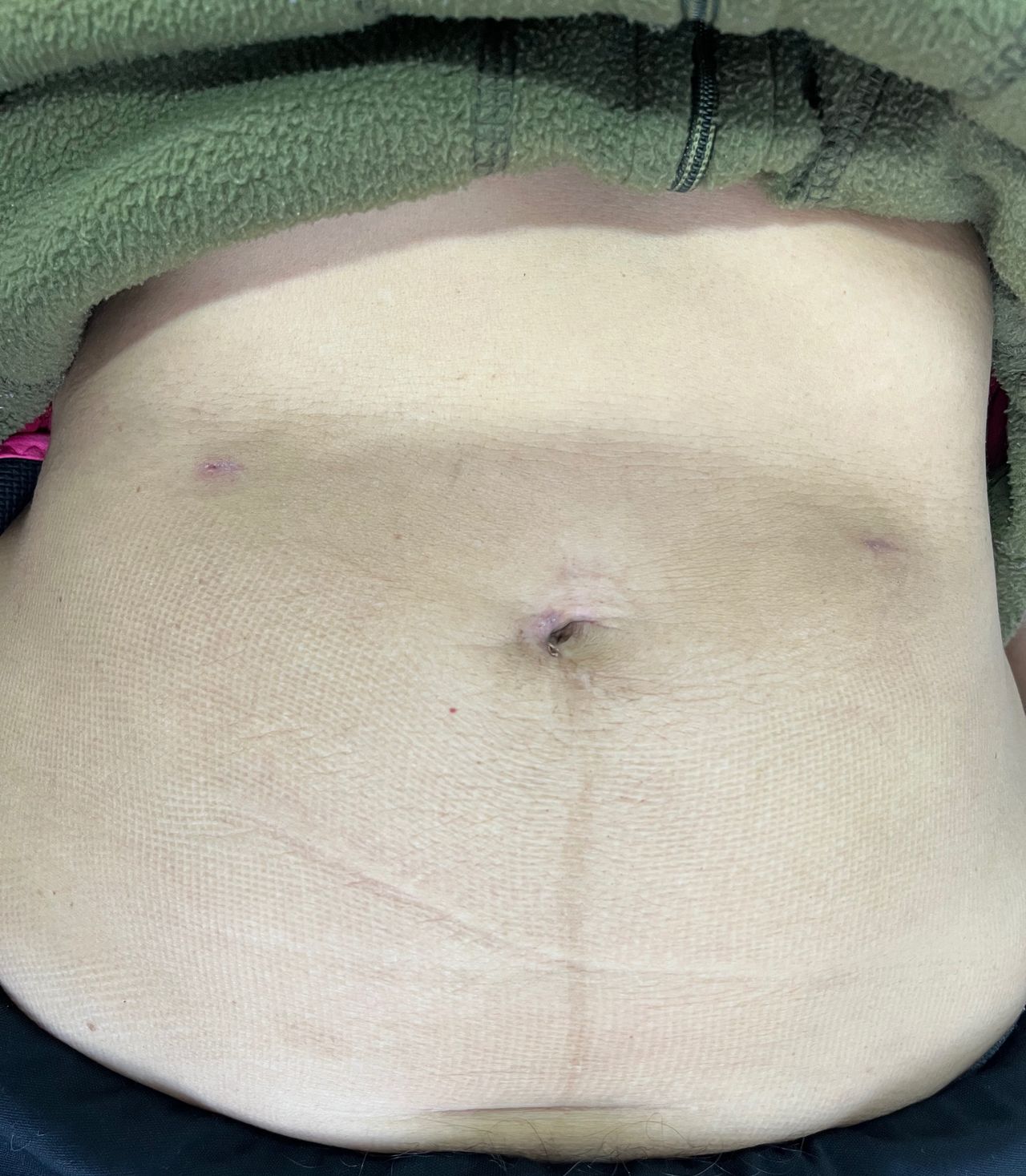 Bernardo Álvarez Hernández-7