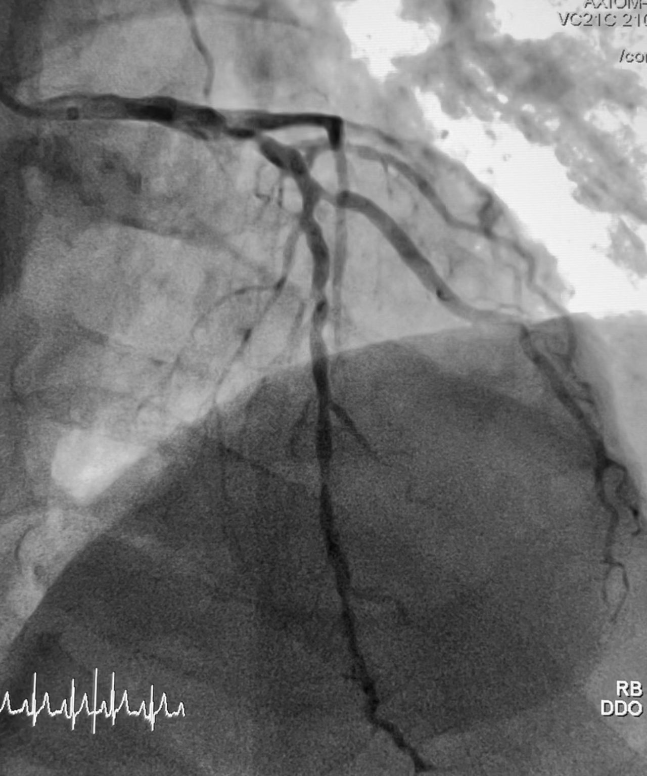 Abdón Ávila Chávez-12