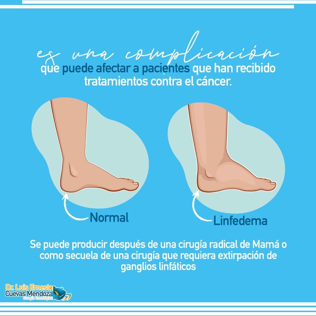 Luis Ernesto Cuevas Mendoza-89