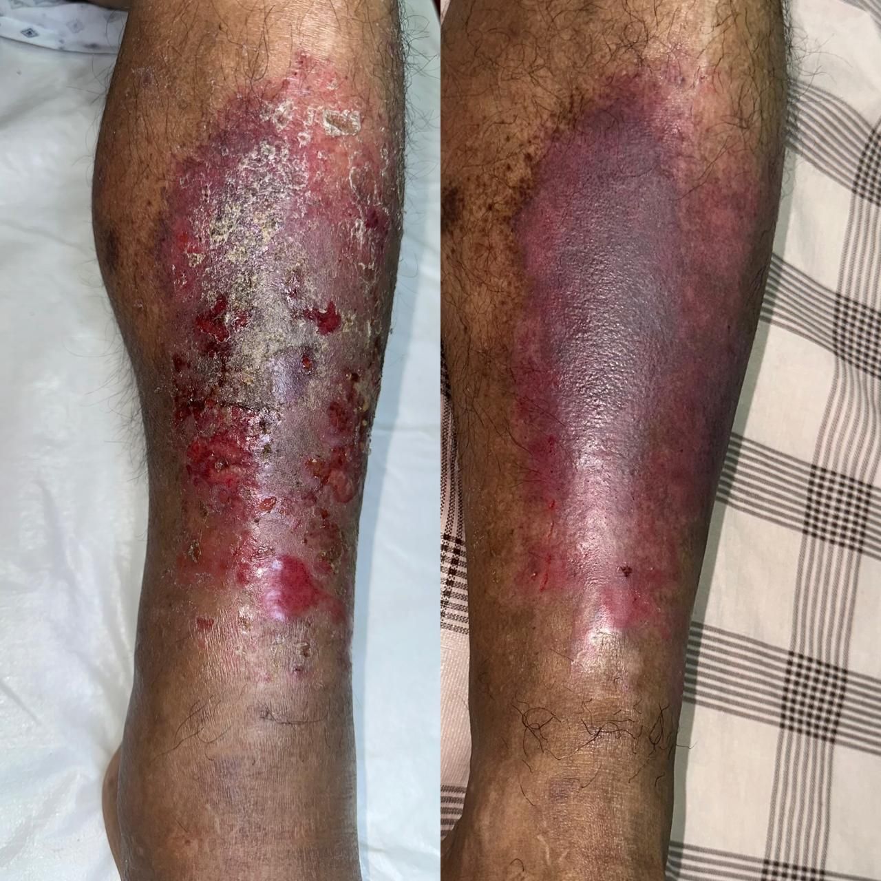 Jhonatan López González-43