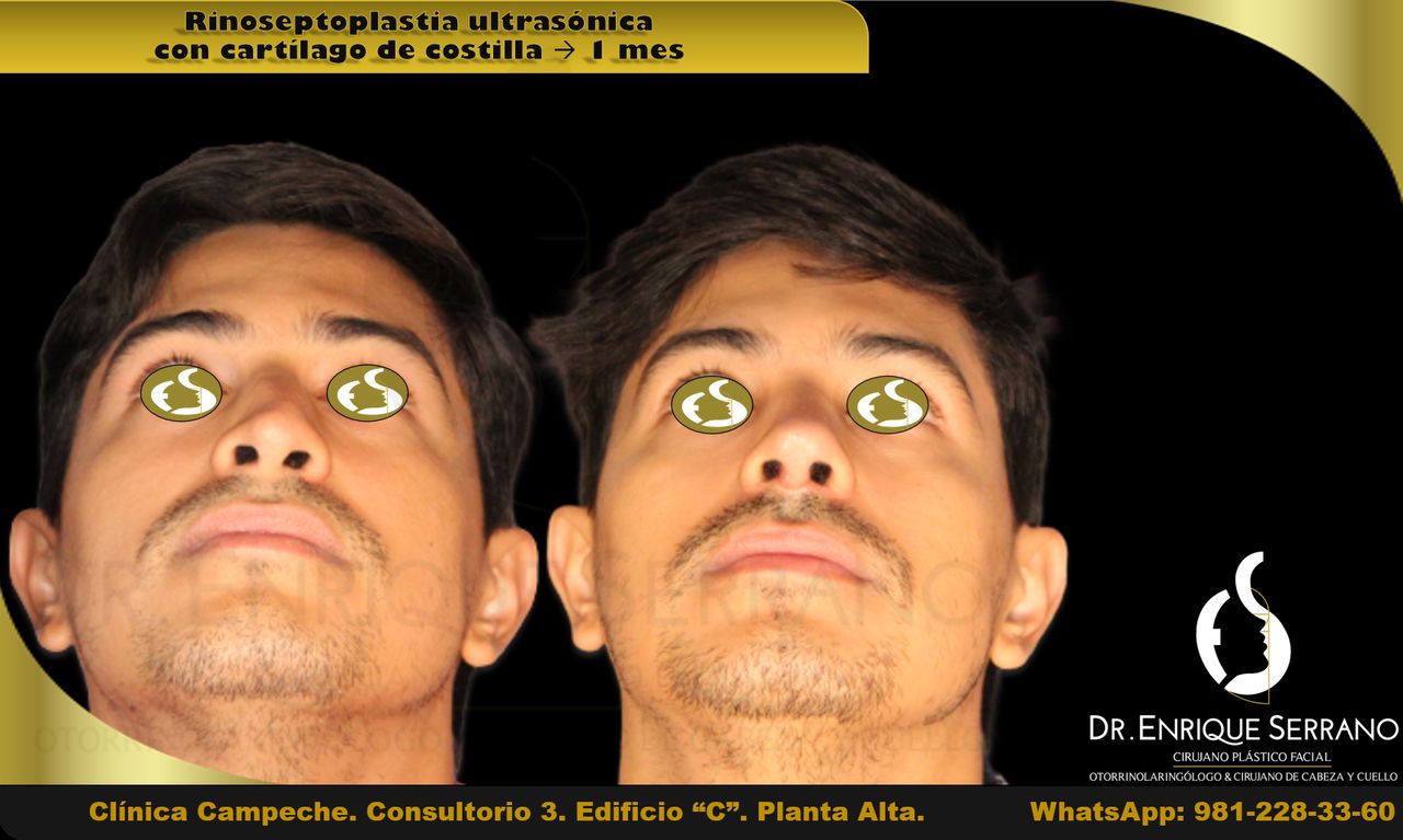 Enrique Serrano Cruz-16