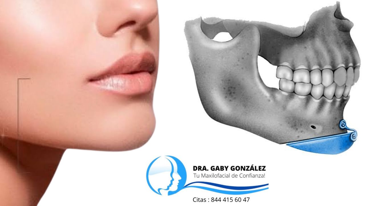 Laura Gabriela González Valdéz-20