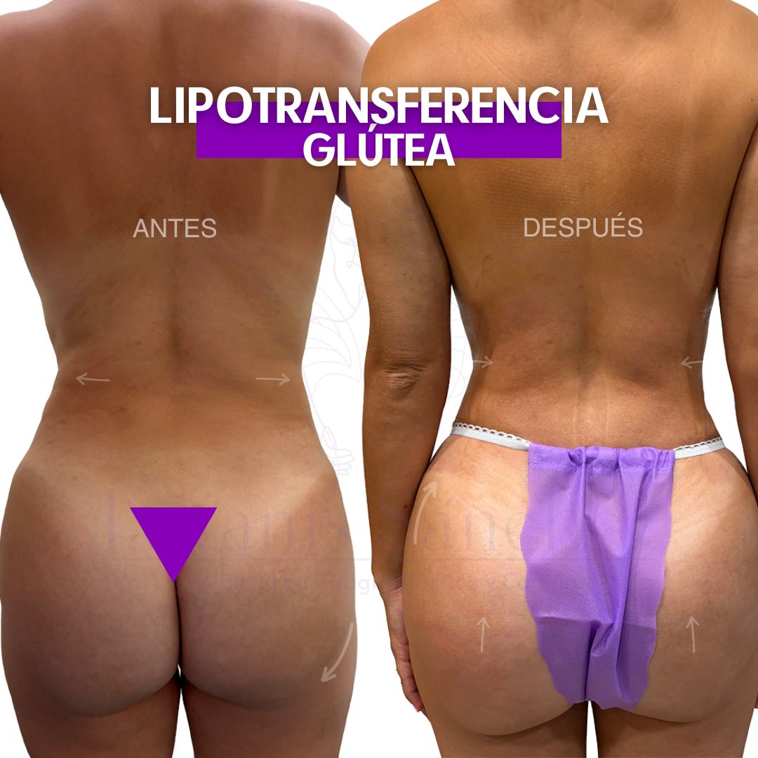 Leyanis Sánchez Hidalgo-5