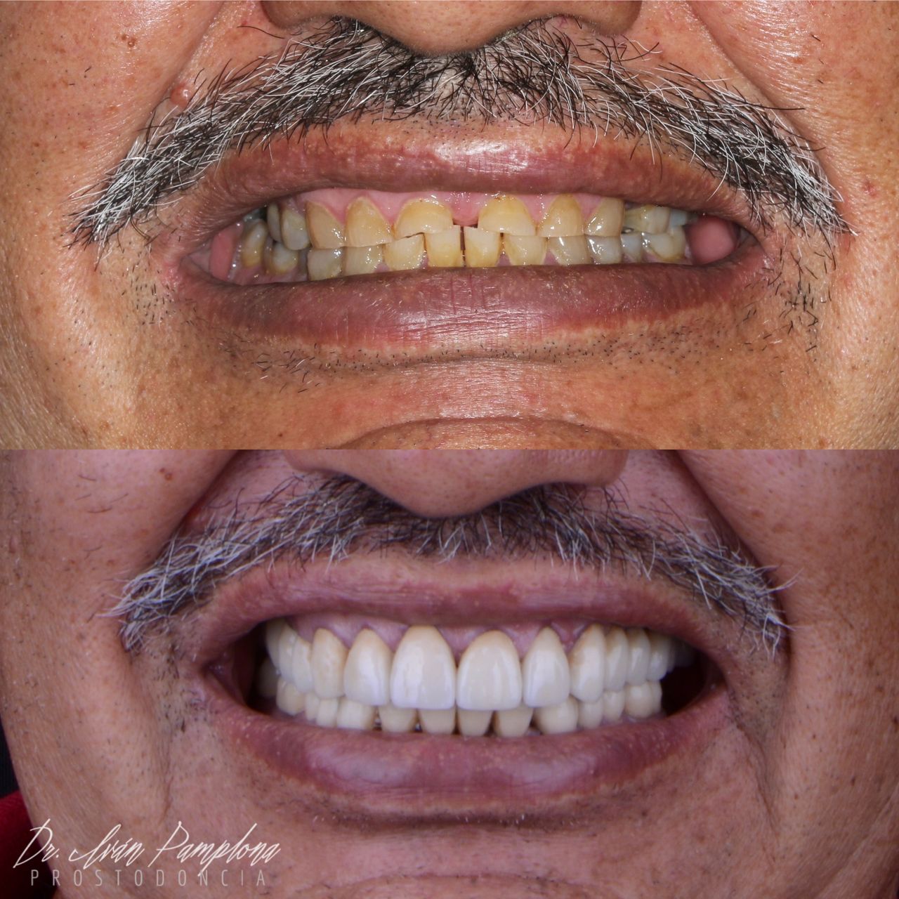 Iván Gerardo Pamplona Alfaro-5