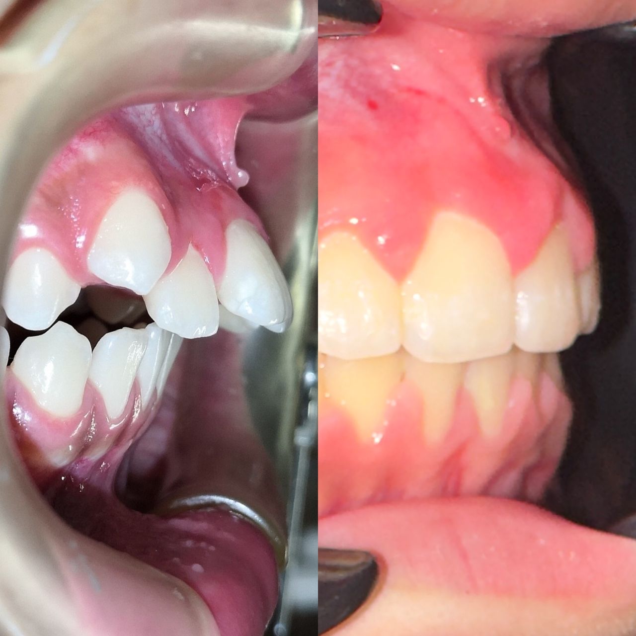 Marvin Adair Hernández Álvarez-17