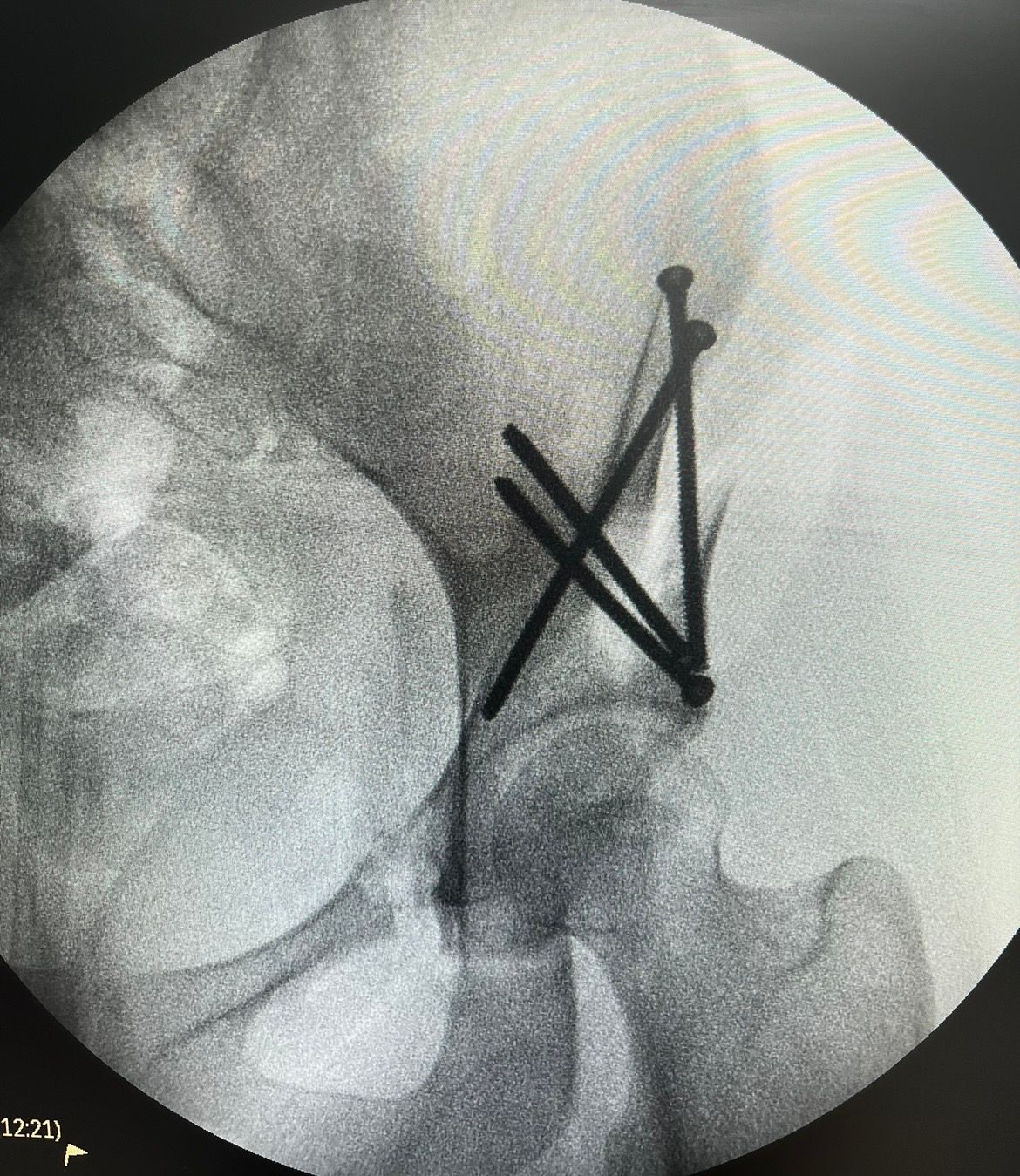 Ozmar Ignacio Ochoa Villar-5