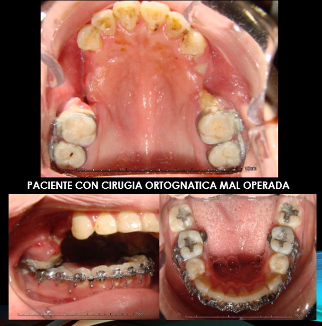 Victor Hugo Sepulveda Núñez-3