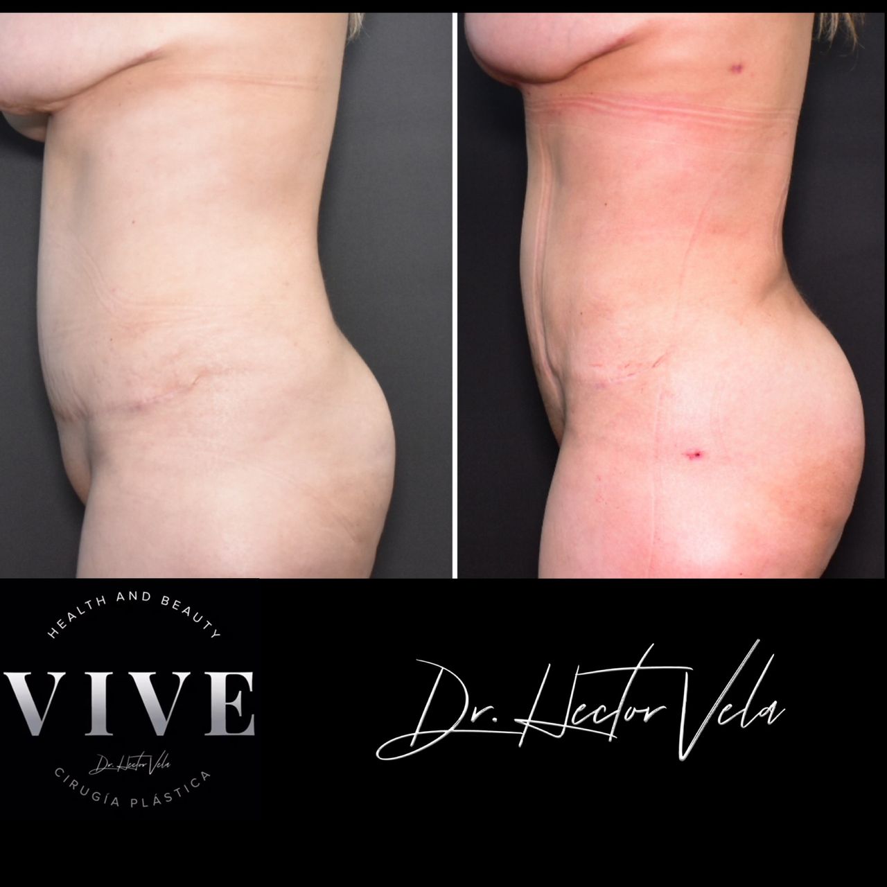 Héctor Eduardo Vela Cardona-333