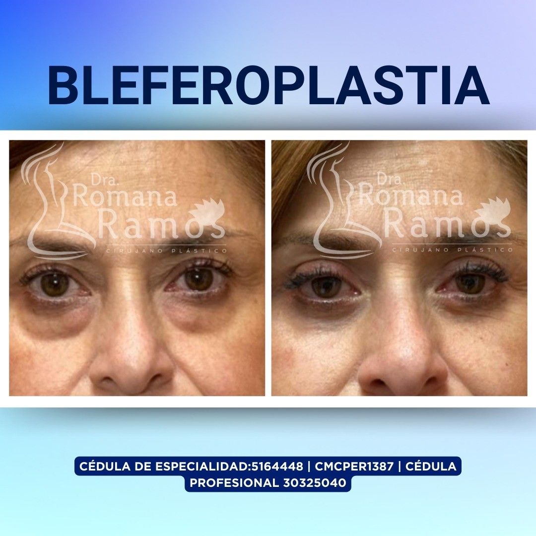 Romana Ramos Cárdenas-7