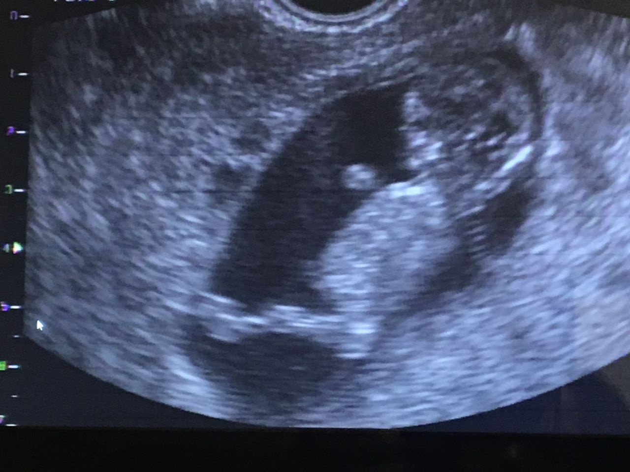 Mayi Mayret Mesquiti-26