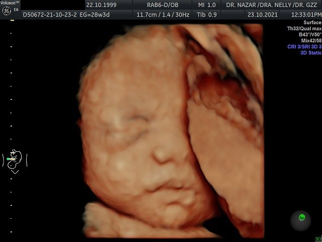 Miguel Angel González Nazar-9