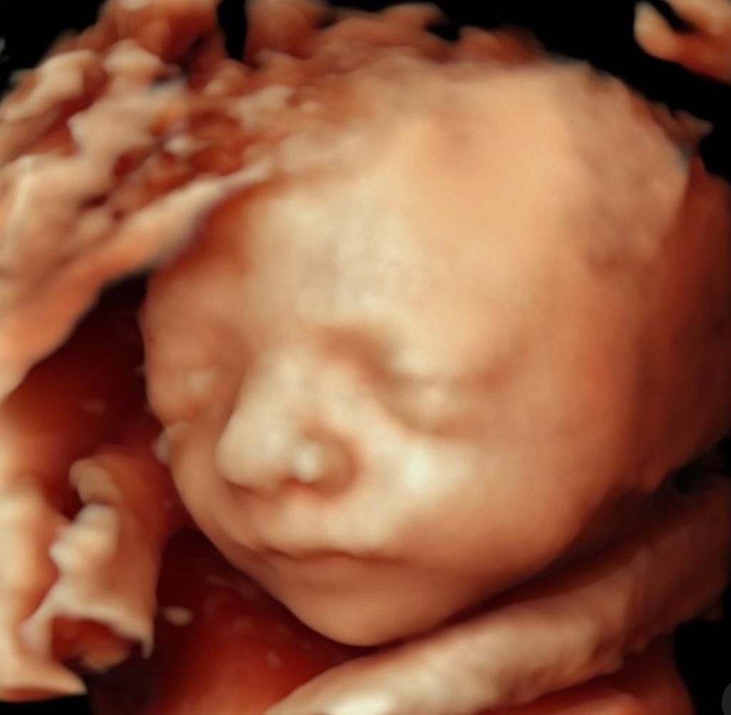 María Teresa Flores Molina-10