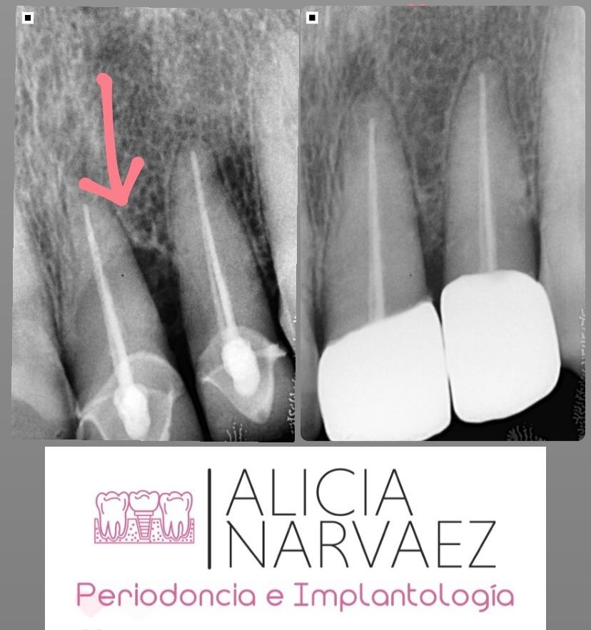 Alicia Narváez Chávez-2